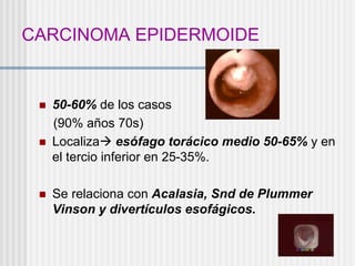 CARCINOMA EPIDERMOIDE
 50-60% de los casos
(90% años 70s)
 Localiza esófago torácico medio 50-65% y en
el tercio inferior en 25-35%.
 Se relaciona con Acalasia, Snd de Plummer
Vinson y divertículos esofágicos.
 