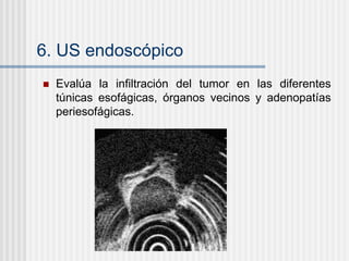 6. US endoscópico
 Evalúa la infiltración del tumor en las diferentes
túnicas esofágicas, órganos vecinos y adenopatías
periesofágicas.
 