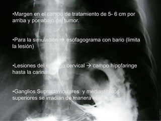 •Margen en el campo de tratamiento de 5- 6 cm por
arriba y por abajo del tumor.
•Para la simulación  esofagograma con bario (limita
la lesión)
•Lesiones del esófago cervical  campo hipofaringe
hasta la carina.
•Ganglios Supraclaviculares y mediastínicos
superiores se irradian de manera electiva.
 