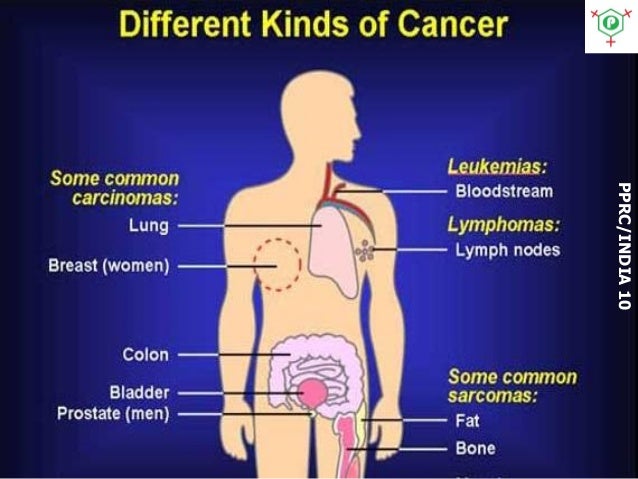 Cancer de pulmon dieta