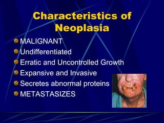 Characteristics of Neoplasia MALIGNANT Undifferentiated Erratic and Uncontrolled Growth Expansive and Invasive Secretes abnormal proteins METASTASIZES 