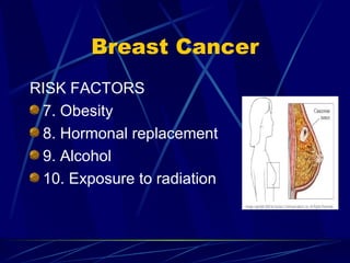 Breast Cancer RISK FACTORS 7. Obesity 8. Hormonal replacement 9. Alcohol 10. Exposure to radiation 