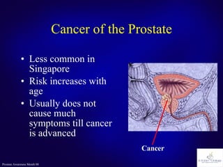 Cancer of the Prostate Less common in Singapore Risk increases with age Usually does not cause much symptoms till cancer is advanced Cancer 