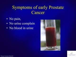 Symptoms of early Prostate Cancer No pain,  No urine complain No blood in urine 