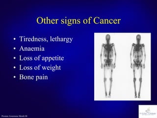 Other signs of Cancer Tiredness, lethargy Anaemia Loss of appetite Loss of weight Bone pain 