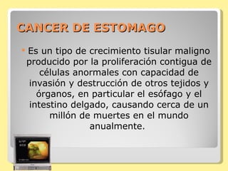 CANCER DE ESTOMAGO Es un tipo de crecimiento tisular maligno producido por la proliferación contigua de células anormales con capacidad de invasión y destrucción de otros tejidos y órganos, en particular el esófago y el intestino delgado, causando cerca de un millón de muertes en el mundo anualmente.  