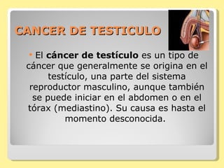 CANCER DE TESTICULO El  cáncer de testículo  es un tipo de cáncer que generalmente se origina en el testículo, una parte del sistema reproductor masculino, aunque también se puede iniciar en el abdomen o en el tórax (mediastino). Su causa es hasta el momento desconocida.  