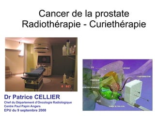Cancer de la prostate Radiothérapie - Curiethérapie ,[object Object],[object Object],[object Object],[object Object]