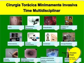 Dia Nacional de Combate ao Câncer Programa Einstein  Cardiologia 