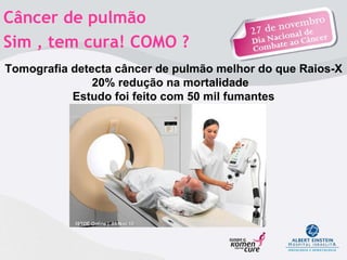 Tomografia detecta câncer de pulmão melhor do que Raios-X 20% redução na mortalidade  Estudo foi feito com 50 mil fumantes ISTOÉ Online |  05.Nov.10  Câncer de pulmão  Sim , tem cura! COMO ?  