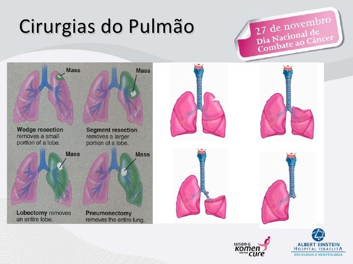 Quando deixado fumando que acontece ao coração