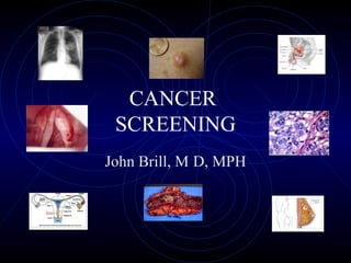 CANCER  SCREENING John Brill, M   D, MPH 