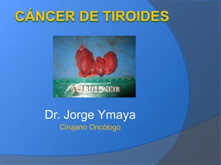 Dr. Jorge Ymaya
Cirujano Oncólogo
 