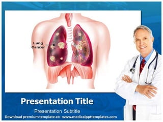 Lung Cancer PowerPoint Template