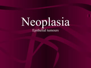 Neoplasia Epithelial tumours 