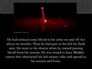 B




 He had noticed some blood in his urine on and off for
 about six months. Then he had pain in the left his flank
   area. He went to the doctor when he started passing
  blood from his rectum. He was found to have Bladder
cancer that obstructed his left urinary tube and spread to
                  his rectum and bone.
 