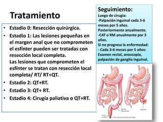Tratamiento
• Estadio 0: Resección quirúrgica.
• Estadio 1: Las lesiones pequeñas en
el margen anal que no comprometen
el esfínter pueden ser tratadas con
resección local completa.
Las lesiones que comprometen el
esfínter se tratan con resección local
completa/ RT/ RT+QT.
• Estadio 2: QT+RT.
• Estadio 3: QT+ RT.
• Estadio 4: Cirugía paliativa o QT+RT.
Seguimiento:
Luego de cirugía:
-Palpación inguinal cada 3-6
meses por 5 años.
Posteriormente anualmente.
-CAT o RM anualmente por 3
años.
Si no progresa la enfermedad:
- Cada 3-6 meses por 5 años:
Examen rectal, anoscopía,
palpación de ganglio inguinal.
 