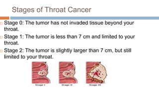 Stages of Throat Cancer
 Stage 0: The tumor has not invaded tissue beyond your
throat.
 Stage 1: The tumor is less than 7 cm and limited to your
throat.
 Stage 2: The tumor is slightly larger than 7 cm, but still
limited to your throat.
 