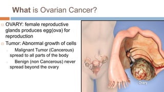 What is Ovarian Cancer?
 OVARY: female reproductive
glands produces egg(ova) for
reproduction
 Tumor: Abnormal growth of cells
o Malignant Tumor (Cancerous)
spread to all parts of the body
o Benign (non Cancerous) never
spread beyond the ovary
 