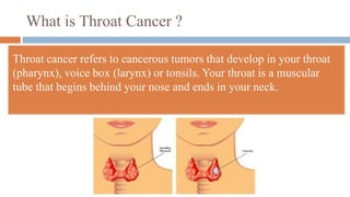 What is Throat Cancer ?
Throat cancer refers to cancerous tumors that develop in your throat
(pharynx), voice box (larynx) or tonsils. Your throat is a muscular
tube that begins behind your nose and ends in your neck.
 