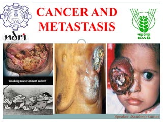 CANCER AND
METASTASIS
Speaker :Sandeep kumar
 