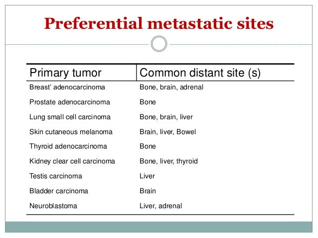 Metastatic Choroidal Melanoma - New York Eye Cancer Center