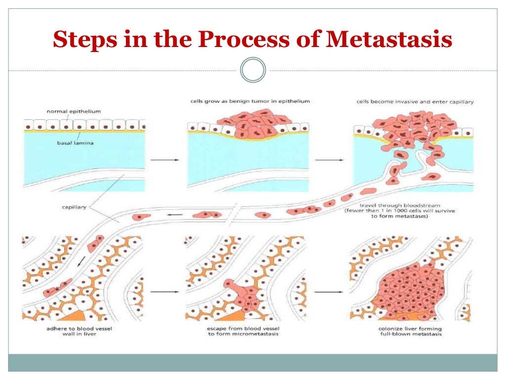 Que significa metastasis