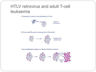 HTLV retrovirus and adult T-cell
leukaemia
 