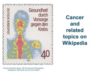 Cancer  and related topics on Wikipedia Cancer prevention stamp, 1981 by Deutsche Bundespost.  Uploaded to Wikimedia Commons by NobbiP 