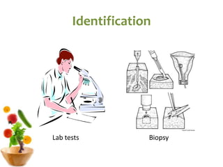 Identification
Biopsy
Lab tests
 