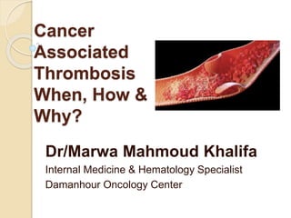 Cancer
Associated
Thrombosis
When, How &
Why?
Dr/Marwa Mahmoud Khalifa
Internal Medicine & Hematology Specialist
Damanhour Oncology Center
 