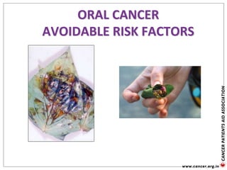 ORAL CANCER
AVOIDABLE RISK FACTORS
 