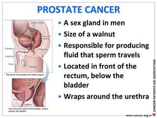 PROSTATE CANCER
• A sex gland in men
• Size of a walnut
• Responsible for producing
fluid that sperm travels
• Located in front of the
rectum, below the
bladder
• Wraps around the urethra
 