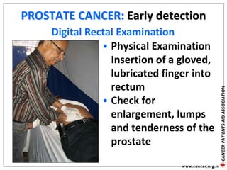 PROSTATE CANCER: Early detection
• Physical Examination
Insertion of a gloved,
lubricated finger into
rectum
• Check for
enlargement, lumps
and tenderness of the
prostate
Digital Rectal Examination
 