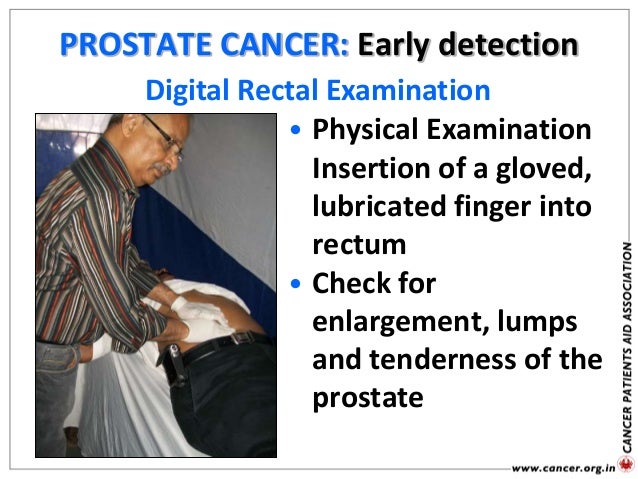 Hip And Leg Ache With Prostate Cancer - The Hip Flexor