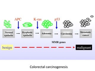Colorectal carcinogenesis
 