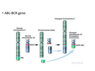 • ABL-BCR gene
 