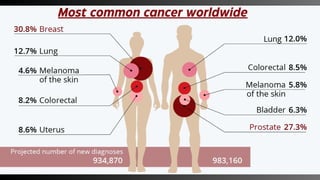 Most common cancer worldwide
 