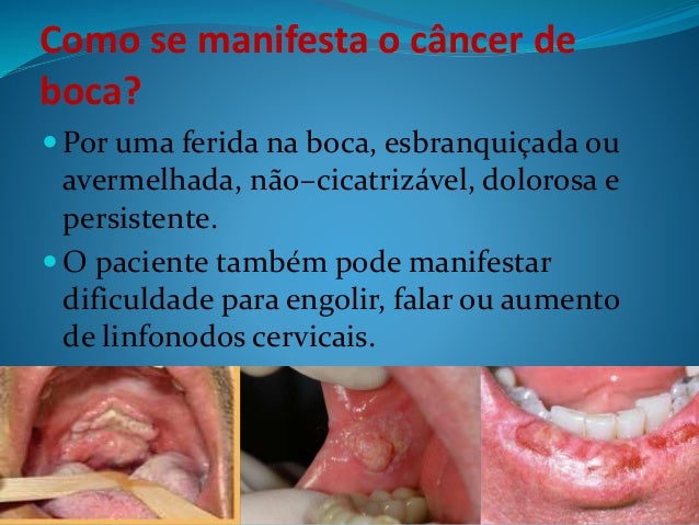 As meninas desenhadas com um lápis com sardas