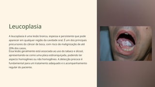 Leucoplasia
A leucoplasia é uma lesão branca, espessa e persistente que pode
aparecer em qualquer região da cavidade oral. É um dos principais
precursores do câncer de boca, com risco de malignização de até
20% dos casos.
Essa lesão geralmente está associada ao uso do tabaco e álcool,
apresentando-se como uma placa esbranquiçada, podendo ter
aspecto homogêneo ou não homogêneo. A detecção precoce é
fundamental para um tratamento adequado e o acompanhamento
regular do paciente.
 