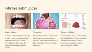 Fibrose submucosa
Características
A fibrose submucosa é uma doença
crônica e progressiva que afeta a
camada submucosa da boca,
levando a uma diminuição da
flexibilidade e mobilidade dos
tecidos.
Sintomas
Pacientes com fibrose submucosa
podem apresentar desconforto,
ardência, dificuldade de abertura da
boca e limitação de movimentação
da língua.
Fatores de Risco
O consumo de areca ou noz de betel
é o principal fator de risco associado
ao desenvolvimento da fibrose
submucosa, especialmente em
algumas regiões da Ásia.
 