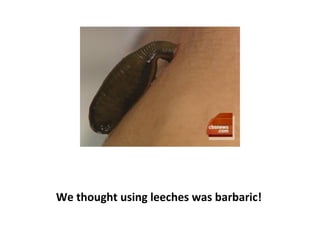 Above is an image of the burning and scarring resulting
“of a spill of chemotherapy onto the bare hand. Is it any
wonder that chemotherapy nurses wear 3 pairs of
protective gloves?
 