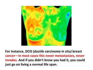 They are diagnosing a lot of cancers that never would
have spread in the first place because they are very
slow-moving and invading.
 