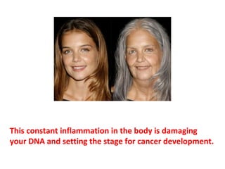Aging is simply an acceleration of inflammation. By the
time you’re in your sixties, the amount of inflammation
in your body is considerable. By the time you are
seventy or eighty, it’s astronomical.
 