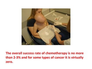 Every year, approximately one million people, nearly
four of five people with cancer, receive chemotherapy
in this country.
 