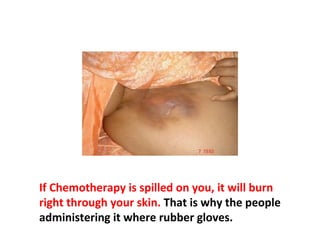 It is well known that chemotherapy kills practically
everything it comes in contact with.
 