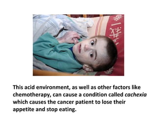 This low oxygen atmosphere is the perfect breeding
ground for cancer and may be the very reason why
advanced cancer patients rarely recover.
 