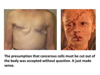 The entire cancer treatment “industry” has been
following a faulty paradigm for close to a hundred years.
 