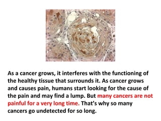 With cancer, it is not enough to merely manage its
symptoms. It’s time for a fundamental change in how
we think about this disease. A paradigm shift is in
order.
 