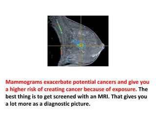 Smashing a woman’s breasts between the plates of the
mammography machine can also be damaging, because
every time they squash it, the cells are pushed out into
the lymphatic system and also the blood vessels, and you
are more likely to cause metastases.
 